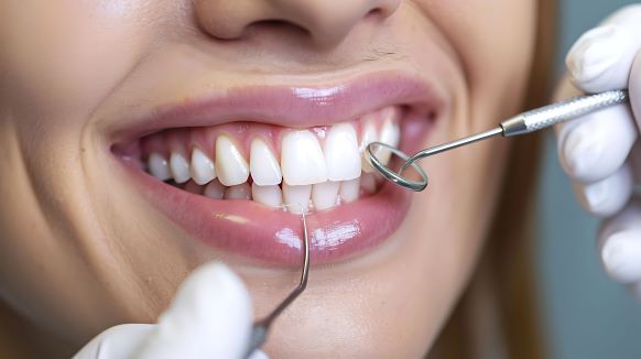 A woman getting her teeth examined by a dentist.