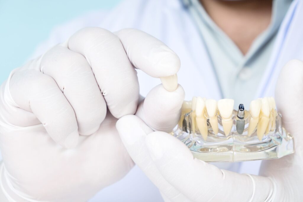 Closeup of a dentist in white gloves holding the crown of a sample dental implant in clear base